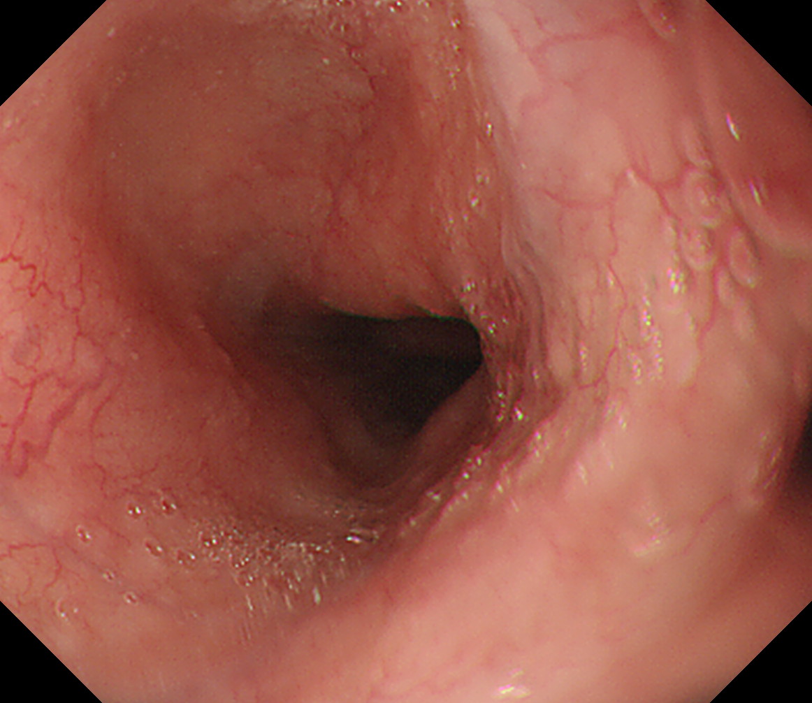 �����H��